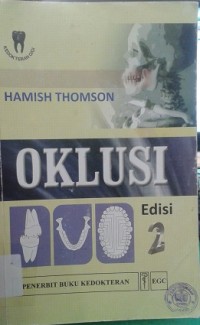 Oklusi